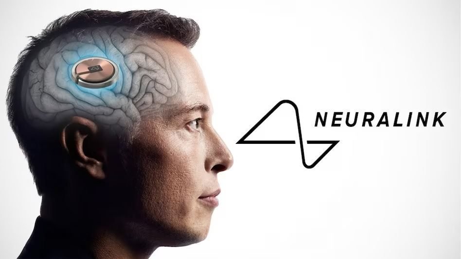 Musk's Neuralink Approved For Brain Implant Human Study