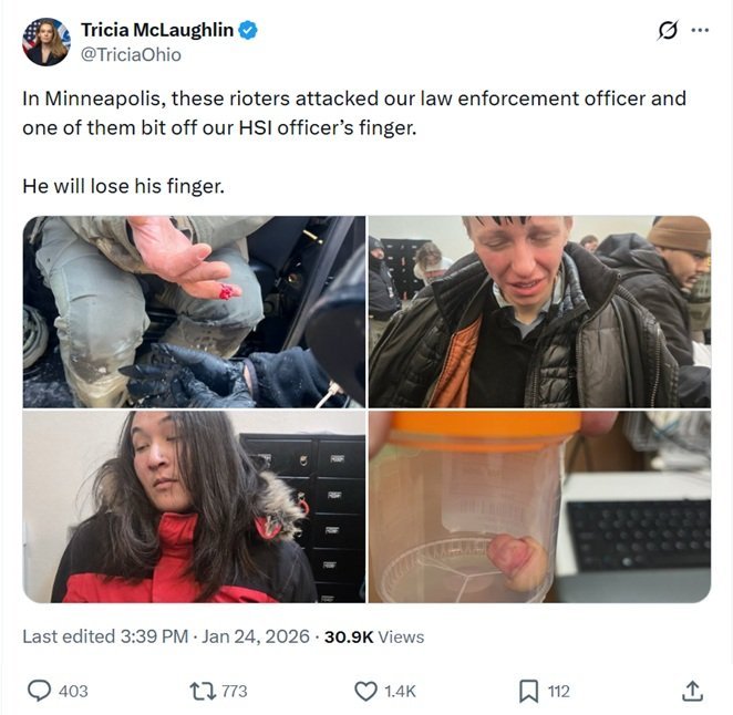 Image showing aftermath of a violent altercation in Minneapolis, including a law enforcement officer with a severed finger and rioters involved in the incident.