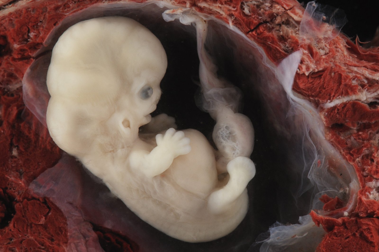 Microscopic view of a developing embryo in a gestational sac, showcasing early stages of human development surrounded by maternal tissue.